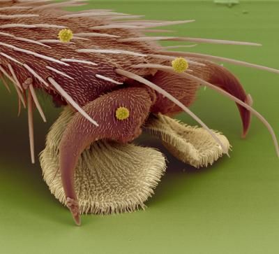 http://i1001.photobucket.com/albums/af138/barrythemod/To%20Forward/microscope-the-foot-of-a-housefly_zps305ad62b.jpg